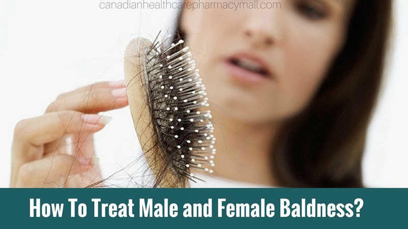 How To Treat Baldness